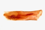 Aedeagus; Henderson County; Jim Petranka.