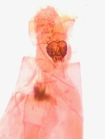 Female genitalia; Brunswick County; Jim Petranka.