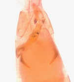 Female genitalia; Moore County; Jim Petranka.