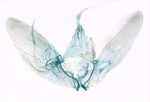 Male genitalia; Ashe County; J.B. Sullivan.