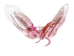 Male genitalia; Moore County; Jim Petranka.