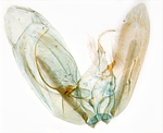 Male genitalia; North Carolina; J.B. Sullivan.