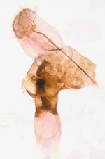 Female genitalia; Ashe County; Jim Petranka.