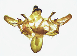 Male genitalia; Wilson County; Jim Petranka.