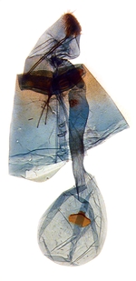 Female genitalia; Jones County; J.B. Sullivan.