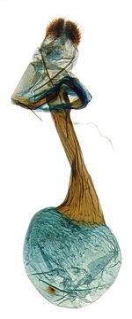Female genitalia; North Carolina; J.B. Sullivan.