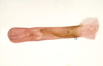Aedeagus; Madison County; Jim Petranka.