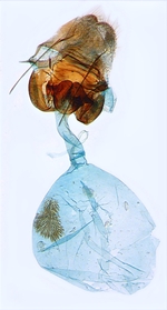 Female genitalia; North Carolina; J.B. Sullivan.