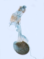 Female genitalia; North Carolina; J.B. Sullivan.