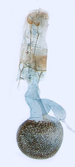 Female genitalia; North Carolina; J.B. Sullivan.