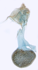 Female genitalia; North Carolina; J.B. Sullivan.
