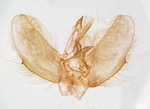 Male genitalia; Madison County; Jim Petranka.