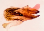 Aedeagus; Rutherford County; Jim Petranka.