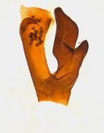 Aedeagus; Madison County; Jim Petranka.