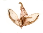 Male genitalia; Henderson County; Jim Petranka.