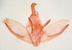 Male genitalia; Rutherford County; Jim Petranka.
