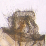 Papillae; North Carolina; J.B. Sullivan.