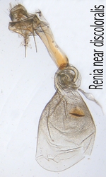 Female genitalia; North Carolina; J.B. Sullivan.