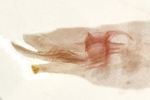 Male genitalia (lateral view); Orange County; Jim Petranka.