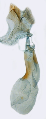 Female genitalia; North Carolina; J.B. Sullivan.