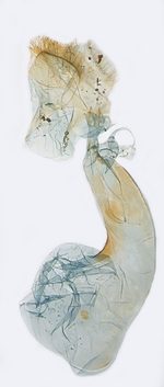 Female genitalia; North Carolina; J.B. Sullivan.