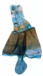 Female genitalia; North Carolina; J.B. Sullivan.