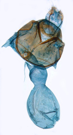 Female genitalia; North Carolina; J.B. Sullivan.