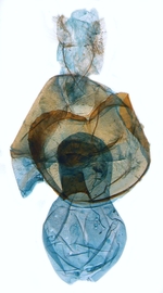 Female genitalia; North Carolina; J.B. Sullivan.