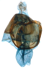 Female genitalia; North Carolina; J.B. Sullivan.