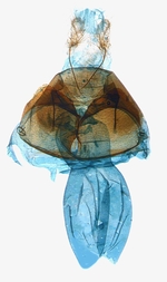 Female genitalia; North Carolina; J.B. Sullivan.