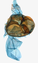 Female genitalia; North Carolina; J.B. Sullivan.