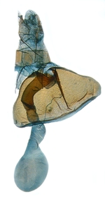 Female genitalia; North Carolina; J.B. Sullivan.
