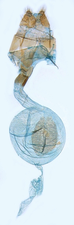 Female genitalia; North Carolina; J.B. Sullivan.