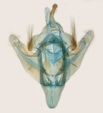 Female genitalia; North Carolina; J.B. Sullivan. 