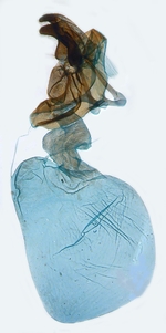 Female genitalia; North Carolina; J.B. Sullivan. 