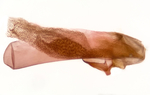Aedeagus; Richmond County; Jim Petranka.