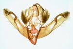 Male genitalia; Henderson County; Jim Petranka. 
