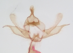 Male genitalia; Orange County; Jim Petranka.