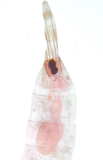 Female genitalia; Mecklenburg County; Jim Petranka.