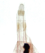 Female genitalia; Mecklenburg County; Jim Petranka.