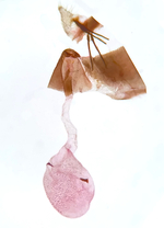 Female genitalia; Orange County; Jim Petranka.