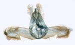 Male genitalia; North Carolina; J.B. Sullivan