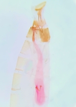 Female genitalia; Madison County; Jim Petranka. 